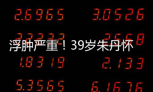 带货怀孕朱丹直播严重月 坚持9岁深夜7个浮肿