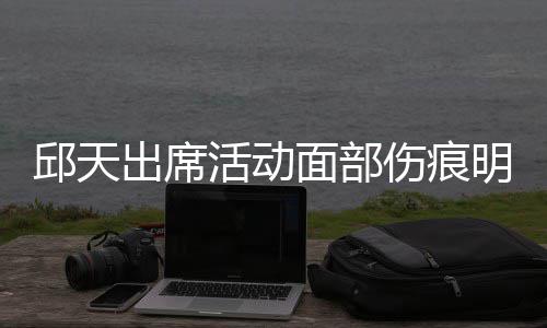 被曝邱天出席休学面部明显活动 曾伤痕生子